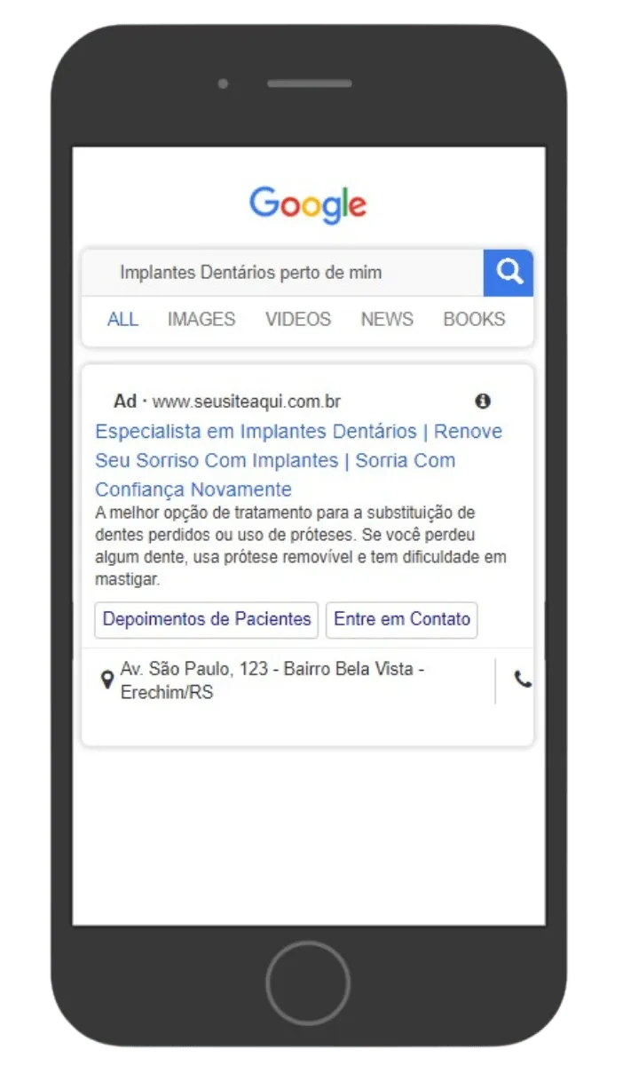 Gestão de tráfego para dentistas: anúncio do Google Ads para a pesquisa Implantes Dentários perto de mim, no celular